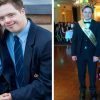 Teenage Couple With Down Syndrome Are Crowned Prom King And Queen By Classmates