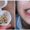 Doctors Are Urging Parents To Keep Their Kids’ Baby Teeth