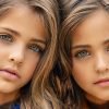 Gorgeous twin girls are dubbed 'most beautiful twin girls in the world'.